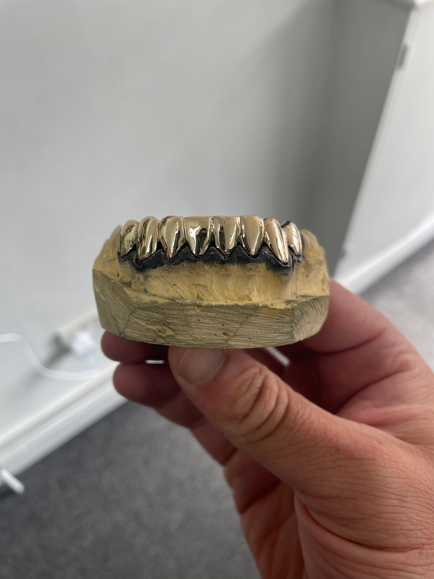 Dental Gold Caps